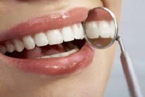 Direct Restorative Materials of Dental Consumables Market