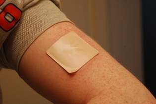 Global Transdermal Absorption Patch Market 2017-2022