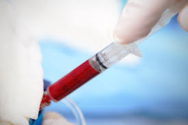 STDs Diagnosis Market